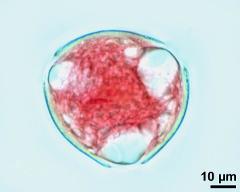 pollen grain with generative cell