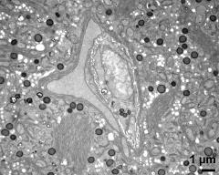 vegetative nucleus (left) and generative cell (right); stacked endoplasmatic reticulum