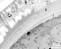 interapertural area of pollen wall, intine (I), endexine (E)