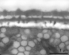 interapertural area of pollen wall