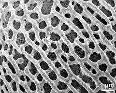 exine surface