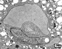 generative cell and vegetaive nucleus