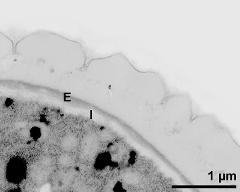 interapertural area of pollen wall, intine (I), endexine (E)