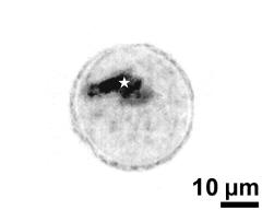 generative cell (asterisk) and vegetetative nucleus
