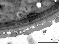 pollen wall, interapertural area