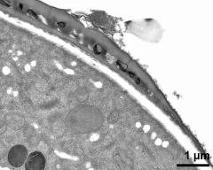 pollen wall at transition of aperture and interapertural area