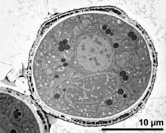 cross section of pollen grain