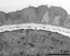 interapertural area of pollen wall