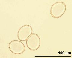 pollen grains in overview