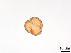 polar view,acetolyzed pollen