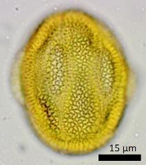 acetolyzed pollen,equatorial view