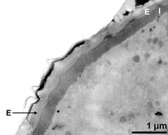 apertural area of pollen wall, intine (I), endexine (E)