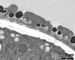 pollen wall; interapertural area