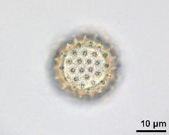 acetolyzed pollen, upper focus