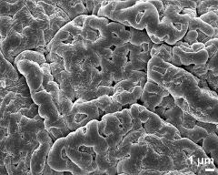 exine surface of dry tetrads