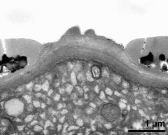 apertural area of pollen wall