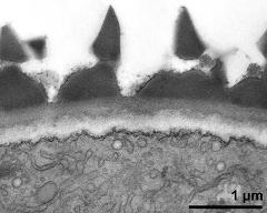 interapertural area of pollen wall