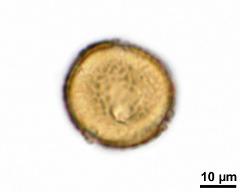 acetolysed pollen, upper focus