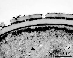 pollen wall (interapertural area)