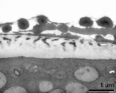 pollen wall at apertural area with Ubisch bodies