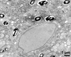 cytoplasm with vegetative nucleus, sperm cell and organells