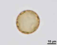 acetolysed pollen, optical section