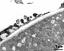 pollen wall at transition of aperture and interapertural area