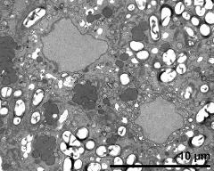 vegetative cell and sperm cell