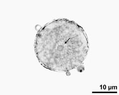 pollen grain with generative cell (arrow)