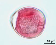 pollen grain with generative cell
