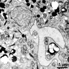 generative cell (top) and vegetative nucleus