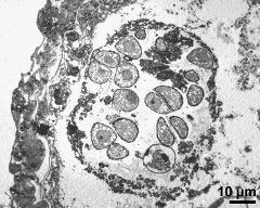 cross section of pollen sac, pollen released from tetrads