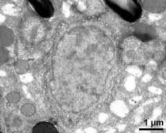 cytoplasm with generative cell