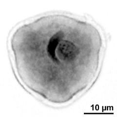 generative cell (left) and vegetative nucleus