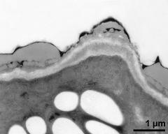 pollen wall, aperture area