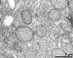 mitochondria in vegetative cytoplasm