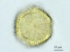 acetolyzed pollen,polar view