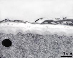 pollen wall at transition of aperture and interapertural area