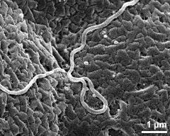 viscin thread on pollen surface