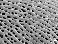 exine surface