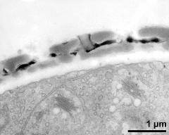 interapertural area of pollen wall