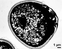 longitudinal section showing sulcus