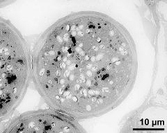 pollen grain in cross section