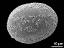 distal polar view