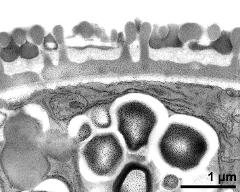 pollen wall, interapertural area, primexine matrix, pollenkitt