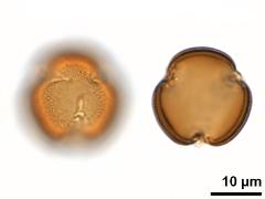 acetolyzed pollen,polar view