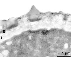 apertural area of pollen wall, intine (I), endexine (E)