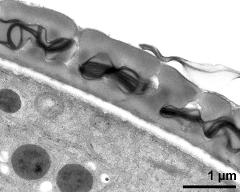 interapertural area of pollen wall