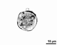 pollen grain with generative cell (arrow)