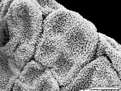 tetrads (forming massula)